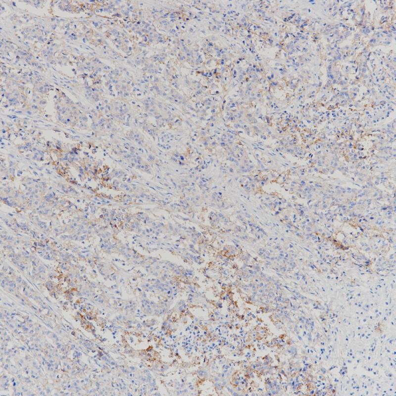 Claudin18.2 Recombinant Rabbit Monoclonal Antibody (clone BP6249)
