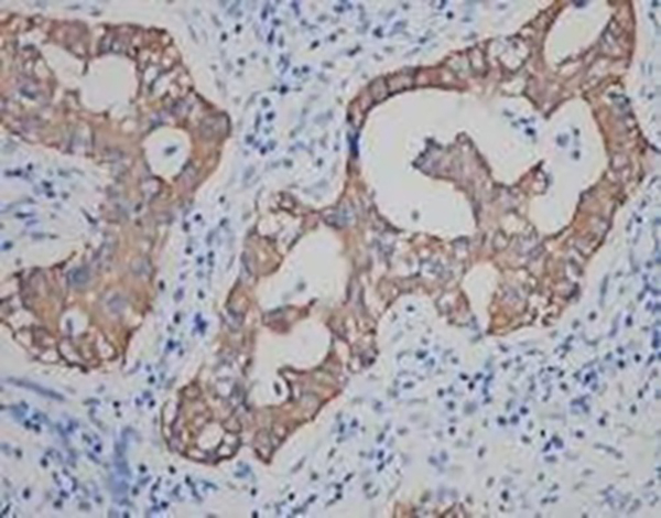 Cytokeratin 8 Recombinant Rabbit Monoclonal Antibody (clone BP6005)