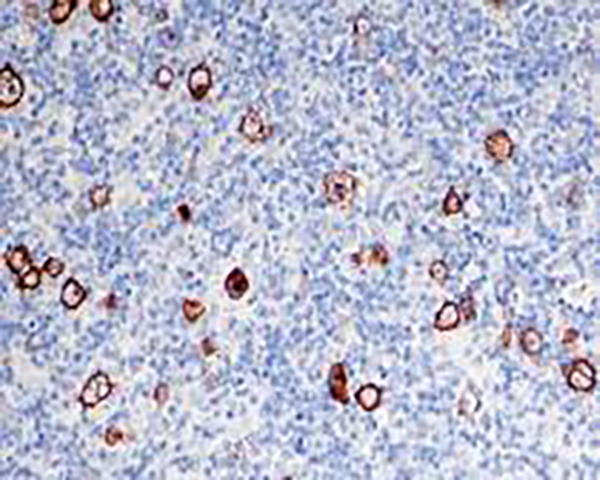 CD30 Recombinant Rabbit Monoclonal Antibody (clone BP6012)
