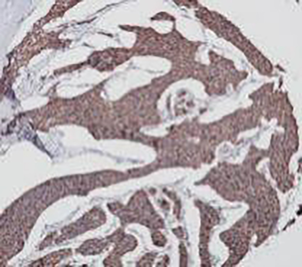 CA125 Recombinant Rabbit Monoclonal Antibody (clone BP6014)