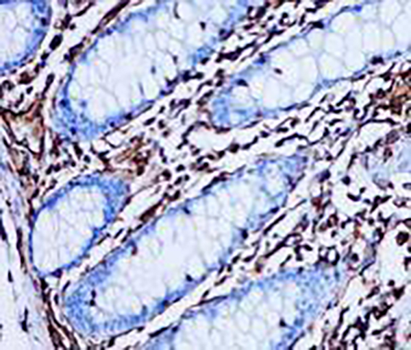 Vimentin Recombinant Rabbit Monoclonal Antibody (clone BP6010)