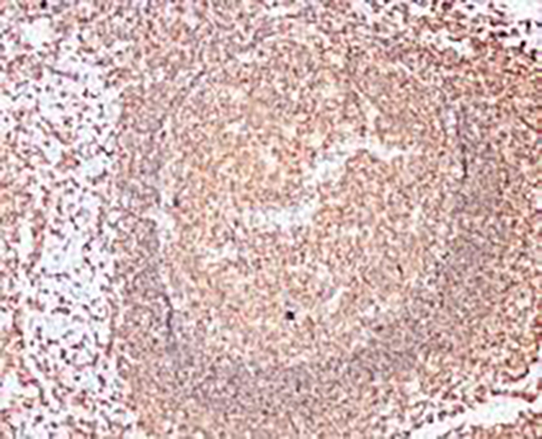 CD20 Recombinant Rabbit Monoclonal Antibody (clone BP6006)