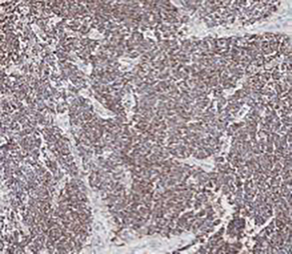 CD99 Recombinant Rabbit Monoclonal Antibody (clone BP6013)