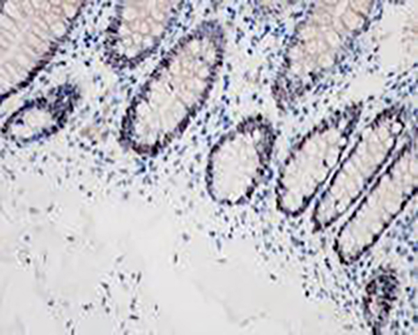MSH6 Recombinant Rabbit Monoclonal Antibody (clone BP6007)