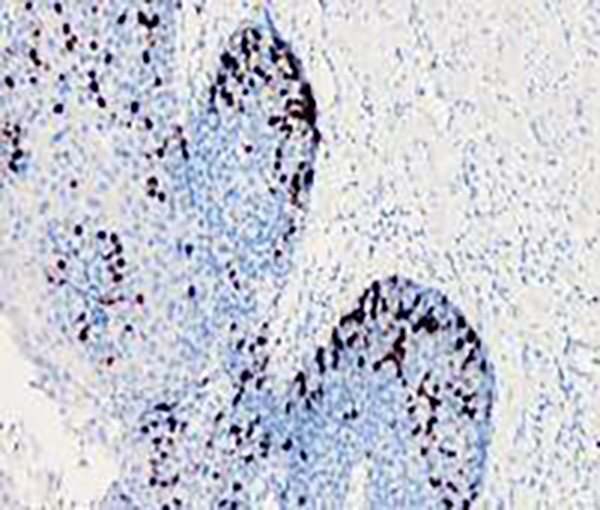 Topoisomerase II-&alpha; Recombinant Rabbit Monoclonal Antibody (clone BP6016)