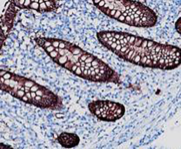 CD1a Recombinant Rabbit Monoclonal Antibody (clone BP6055)