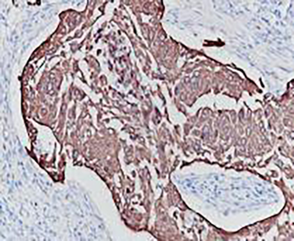 Type I Cytokeratins Recombinant Rabbit Monoclonal Antibody (clone BP6051)