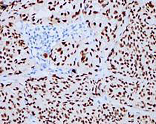 CDX2 Recombinant Rabbit Monoclonal Antibody (clone BP6023)