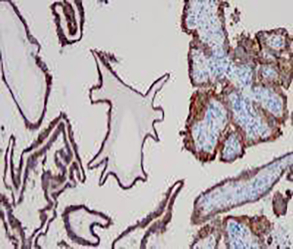 Cytokeratin 5 Recombinant Rabbit Monoclonal Antibody (clone BP6021)
