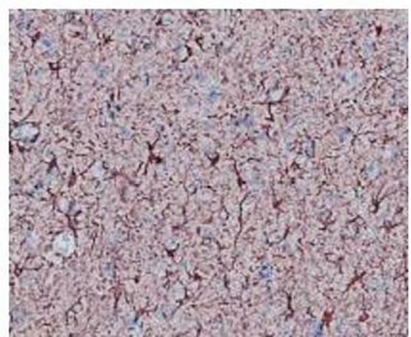 EpCAM Recombinant Rabbit Monoclonal Antibody (clone BP6056)