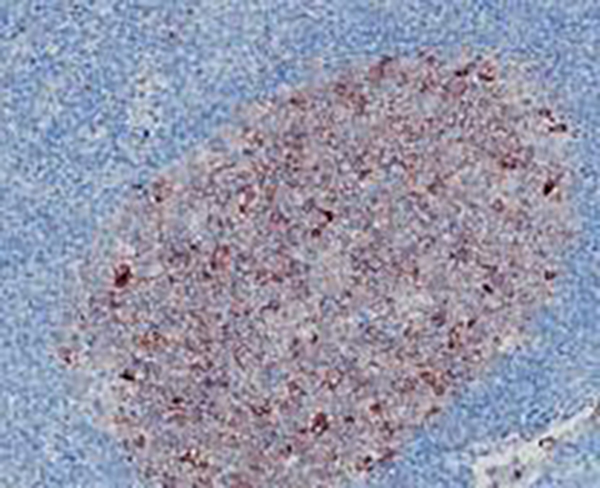 Cytokeratin 7 Recombinant Rabbit Monoclonal Antibody (clone BP6060)