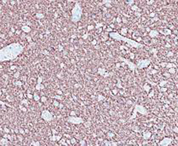 Cytokeratin 14 Recombinant Rabbit Monoclonal Antibody (clone BP6052)