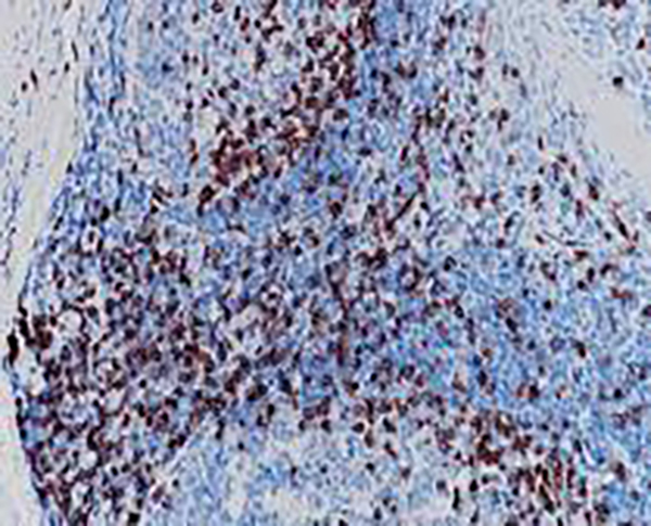 p63 Recombinant Rabbit Monoclonal Antibody (clone BP6038)
