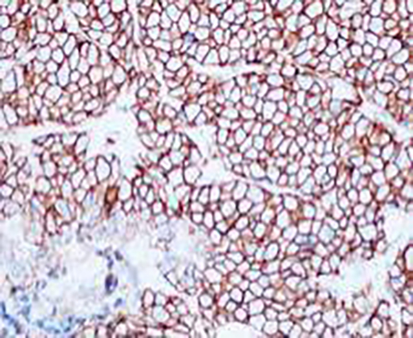 Cytokeratin 20 Recombinant Rabbit Monoclonal Antibody (clone BP6030)