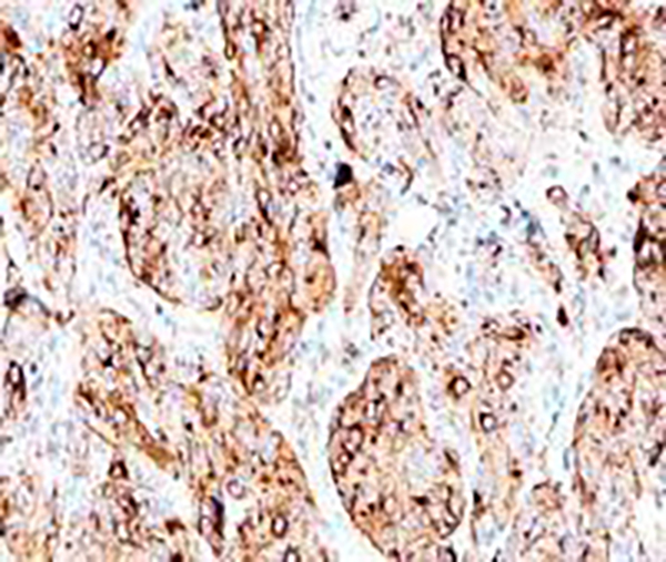 CD79a Recombinant Rabbit Monoclonal Antibody (clone BP6040)