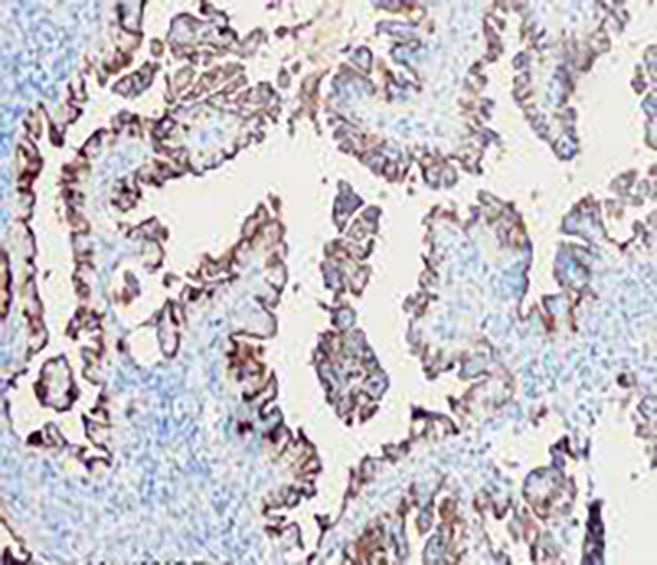 p40 Recombinant Rabbit Monoclonal Antibody (clone BP6033)