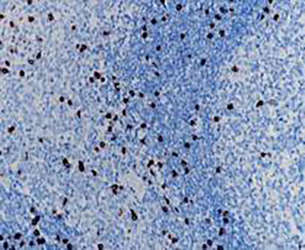 CD8 Recombinant Rabbit Monoclonal Antibody (clone BP6041)