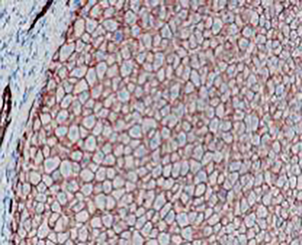 E-Cadherin Recombinant Rabbit Monoclonal Antibody (clone BP6048)