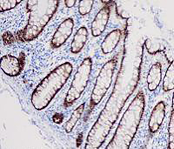 Cytokeratin 19 Recombinant Rabbit Monoclonal Antibody (clone BP6022)