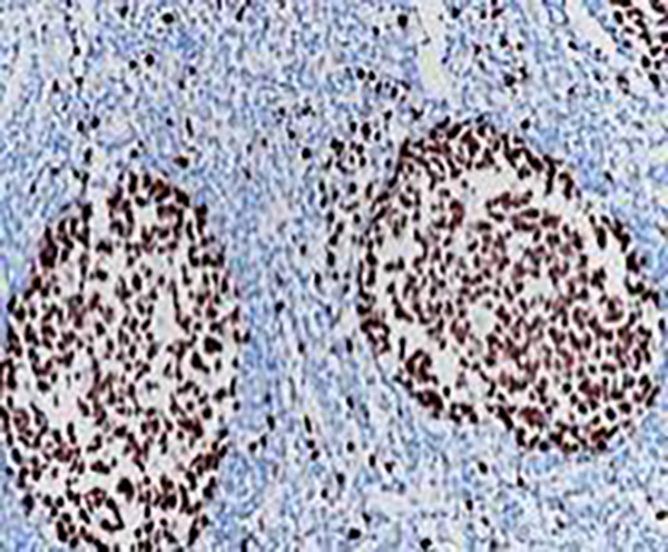 Ki-67 Recombinant Rabbit Monoclonal Antibody (clone BP6045)