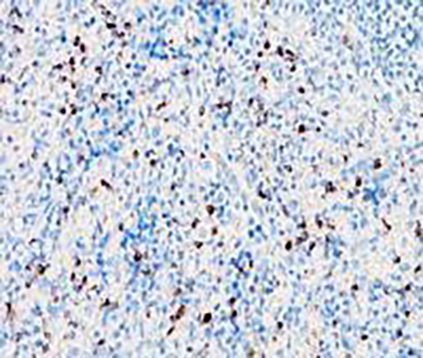 CD4 Recombinant Rabbit Monoclonal Antibody (clone BP6028)