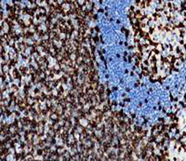 Estrogen Receptor (ER) &alpha; Recombinant Rabbit Monoclonal Antibody (clone BP6026)