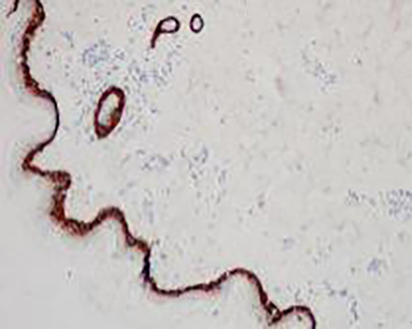 HER-2 Recombinant Rabbit Monoclonal Antibody (clone BP6020)