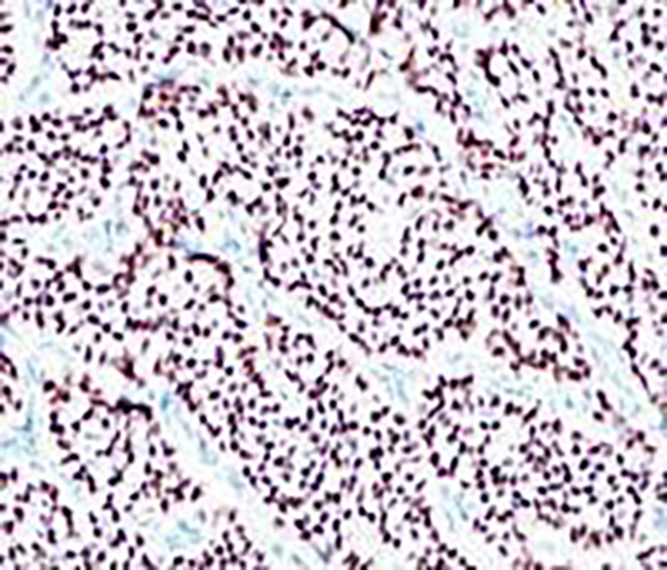 SOX10 Recombinant Rabbit Monoclonal Antibody (clone BP6024)