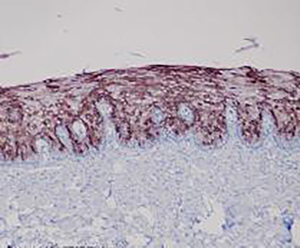 Type II Cytokeratins Recombinant Rabbit Monoclonal Antibody (clone BP6058)