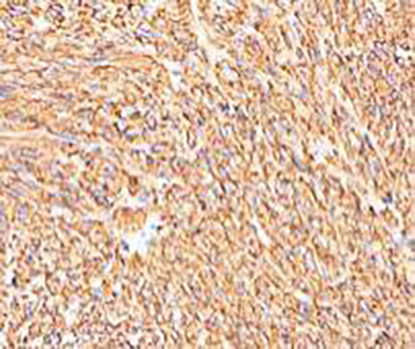 PMEL17 Recombinant Rabbit Monoclonal Antibody (clone BP6031)