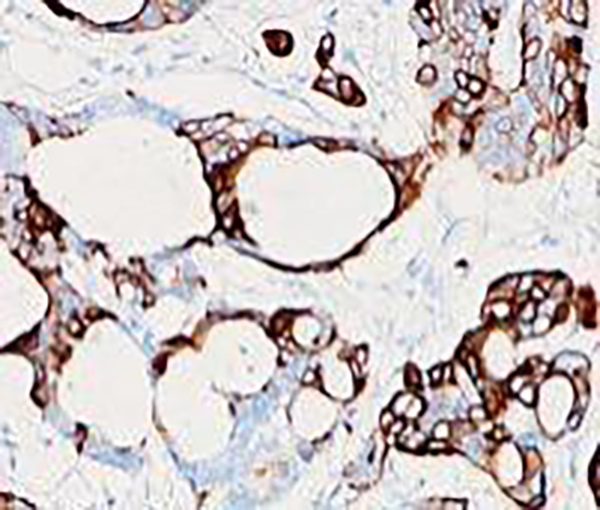 Granzyme B Recombinant Rabbit Monoclonal Antibody (clone BP6029)