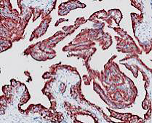 PSAP Recombinant Rabbit Monoclonal Antibody (clone BP6050)
