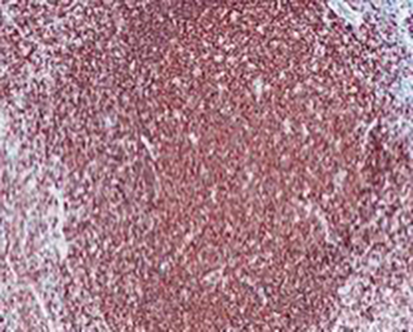 CD19 Recombinant Rabbit Monoclonal Antibody (clone BP6046)