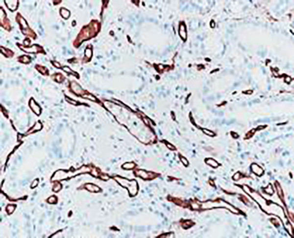 CD34 Recombinant Rabbit Monoclonal Antibody (clone BP6047)