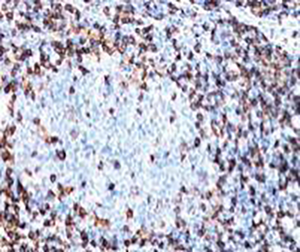 CD3 Recombinant Rabbit Monoclonal Antibody (clone BP6027)