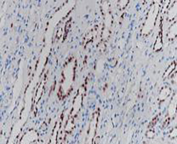PAX-2 Recombinant Rabbit Monoclonal Antibody (clone BP6044)