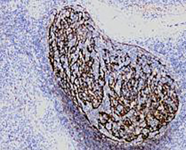 CD21 Recombinant Rabbit Monoclonal Antibody (clone BP6015)