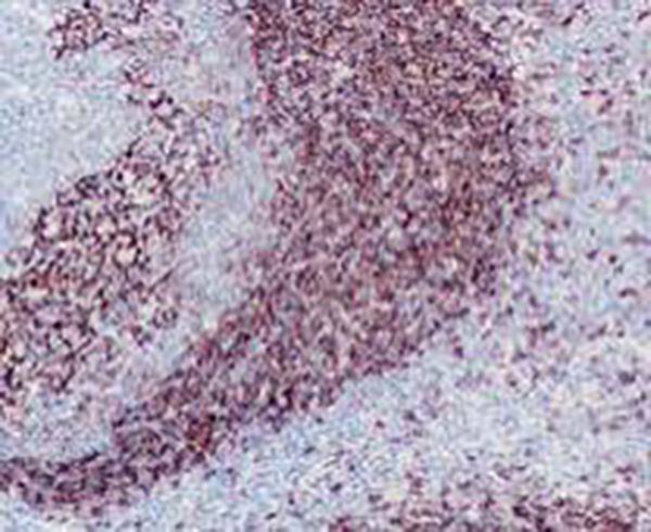 CD23 Recombinant Rabbit Monoclonal Antibody (clone BP6049)