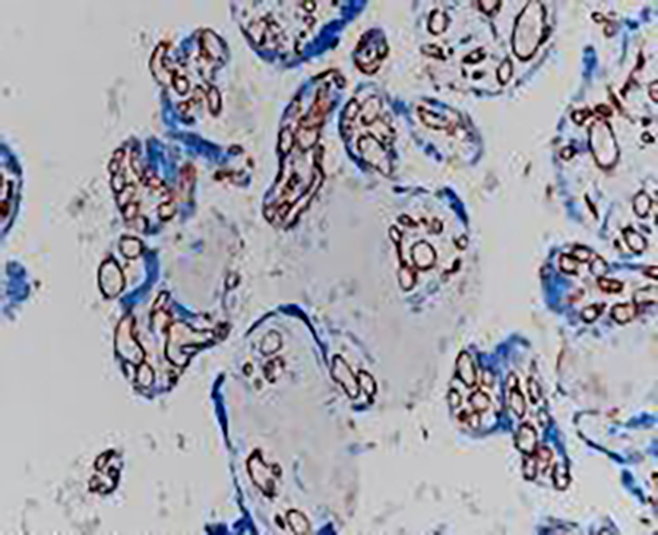 CD68 Recombinant Rabbit Monoclonal Antibody (clone BP6036)