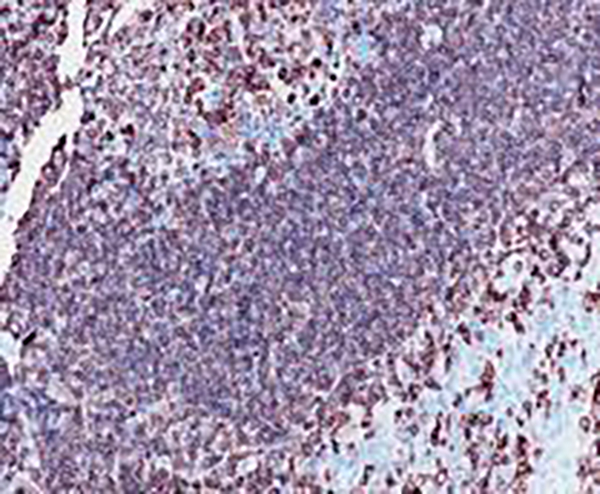 CD3 Recombinant Rabbit Monoclonal Antibody (clone BP6039)