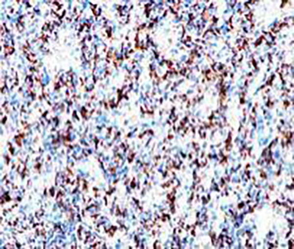 CD138 Recombinant Rabbit Monoclonal Antibody (clone BP6035)