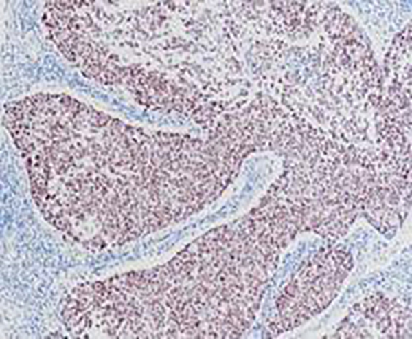 CD31 Recombinant Rabbit Monoclonal Antibody (clone BP6037)