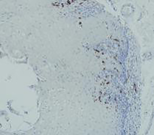 Cytokeratin 18 Recombinant Rabbit Monoclonal Antibody (clone BP6054)
