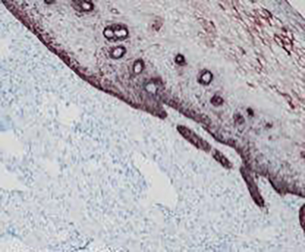 GFAP Recombinant Rabbit Monoclonal Antibody (clone BP6061)