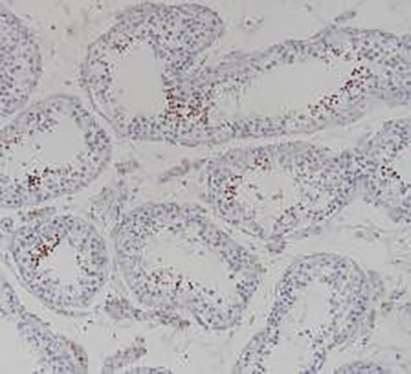 NUT1 Recombinant Rabbit Monoclonal Antibody (clone BP6221)