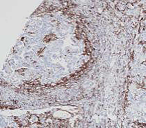 IgA Recombinant Rabbit Monoclonal Antibody (clone BP6169)