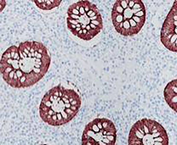 Cytokeratin 6 Recombinant Rabbit Monoclonal Antibody (clone BP6065)