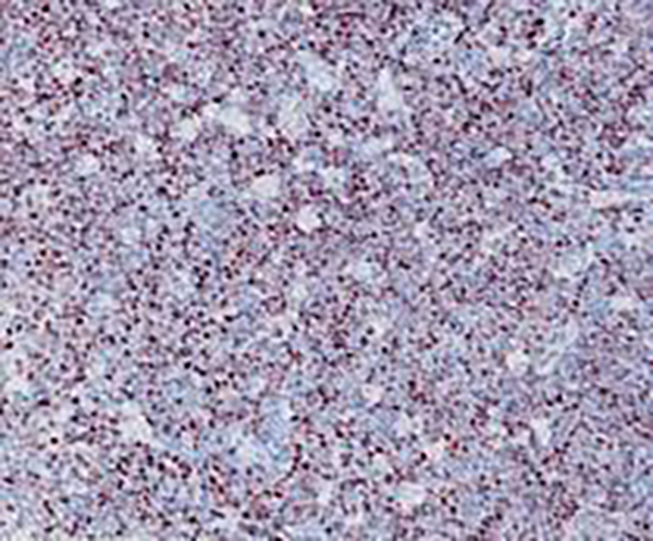 CD35 Recombinant Rabbit Monoclonal Antibody (clone BP6069)