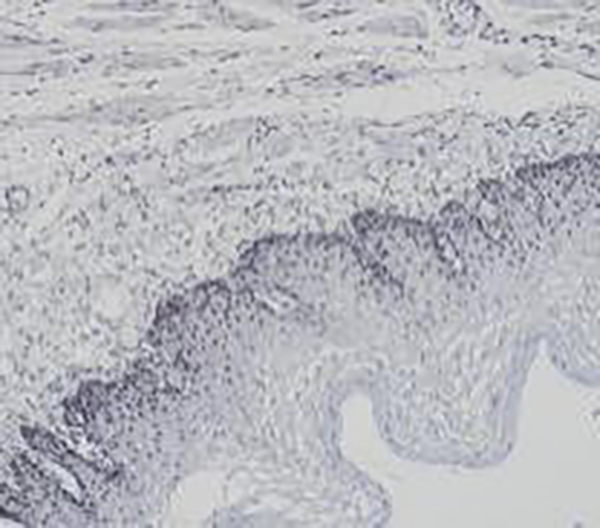 Cytokeratin (HMW) Recombinant Rabbit Monoclonal AntibodyCocktail (clone BP6021/BP6077)