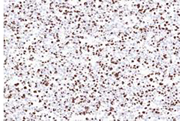 MYD88 L265P Recombinant Rabbit Monoclonal Antibody (clone BP6242)